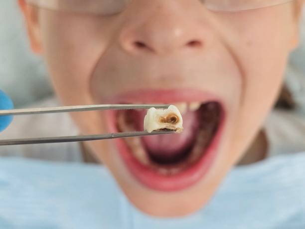 Best Pediatric Emergency Dentist in St Matthews, SC